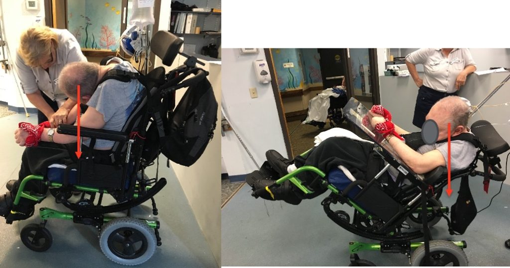 Choosing the Right Postural Seating Wheelchair