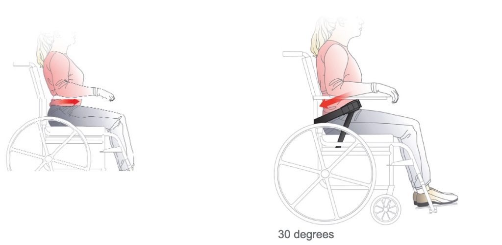 Benefits of Postural Seating Wheelchairs