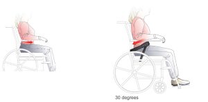 Benefits of Postural Seating