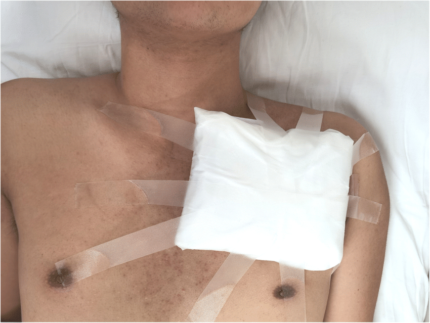 Pressure Injury Dressing Options: What You Need to Know